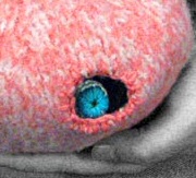 Knitted teratoma Knitted teratoma