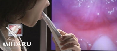Dental Camera